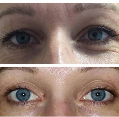 30-1-im-slider_imgage-1508