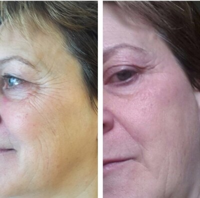 30-2-im-slider_imgage-2127