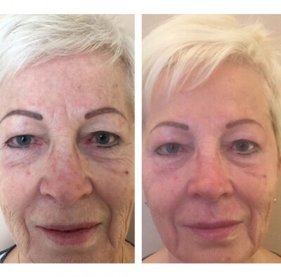 30-3-im-slider_imgage-2893